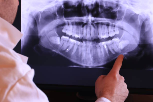 Best Emergency Broken Tooth Repair in Powder Springs, GA